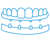 Prótesis Fija y Removible